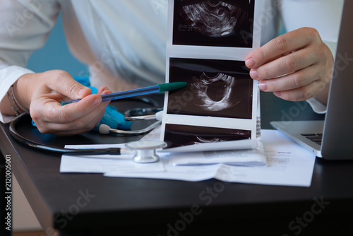 Fotografie doctor pointing with pen at gynecological ultrasound images in medical clinic cl