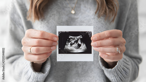 A woman holds a Polaroid photo of a sonogram showing a baby in the womb, symbolizing pregnancy and new life