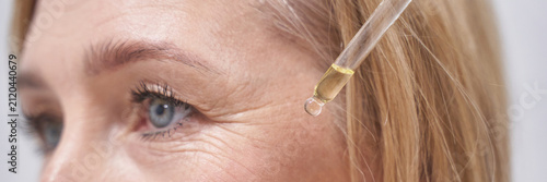 Woman Applying Facial Oil With Glass Dropper Near Outer Eye Area Showing Fine Wrinkles In Horizontal Close Up Cosmetic Skin Care Routine Shot.