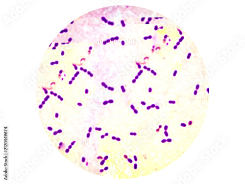Gram positive Streptococcus pneumoniae or  pneumococci analyzed by light microscope.