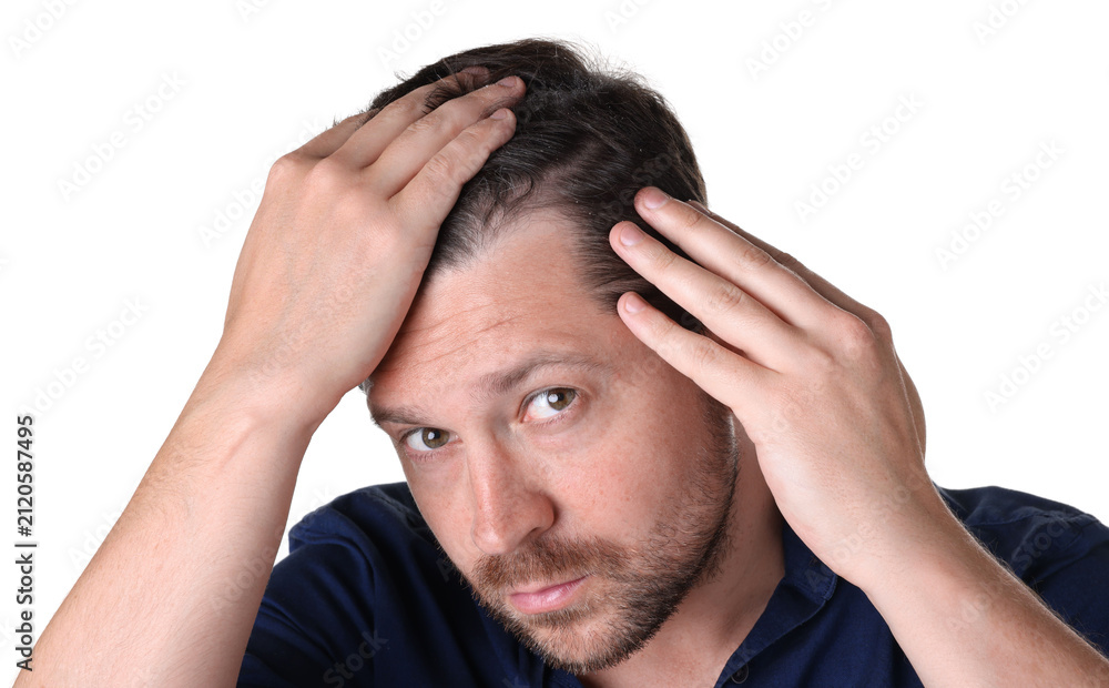 Fototapeta premium Dandruff problem. Man examining his head on white background