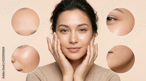 Woman face with highlighted skin problem zones and closeup sections. Concept of dermatology diagnostics, skincare analysis, aesthetic medicine, and facial treatment design. Collage