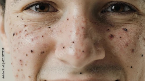 Close-up time-lapse of skin texture changes over time