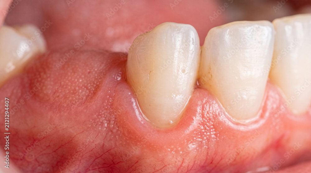 Fototapeta premium Close-up view of healthy gums and teeth showcasing pink and white hues, highlighting dental anatomy