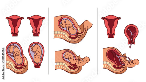 Vector Illustration of Fetal Position and Birth Process