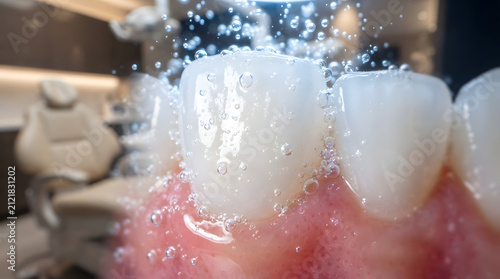 Macro view of white human teeth with fresh water bubbles
