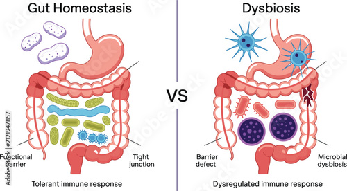 Konstfotografi Gut Homeostasis and Dysbiosis Medical Infographic Comparing Healthy Gut Microbio