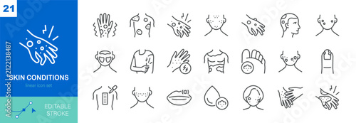 Simple Set of Skin Conditions Related Vector Line Dermatology Icons. Contains such Icons as Psoriasis, Vitiligo, Rosacea, Rash, Alopecia and More. Editable Stroke. Pixel Perfect Vector.