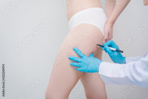 Doctor in blue gloves marking a woman’s thigh before a cosmetic leg procedure in a clean clinic setting, showing body contour planning, beauty care, and medical treatment.