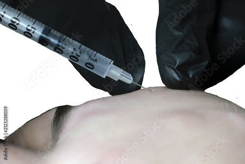 woman lies in an armchair, receiving a cosmetic injection, a close-up of a rejuvenating injection in the forehead,