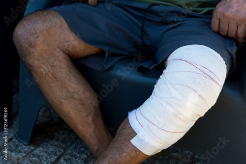 Close-up view of a man sitting down outdoors in shorts, showing a heavily wrapped white medical bandage on his injured knee joint.