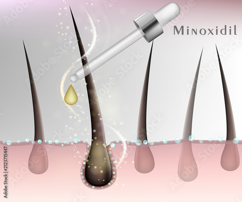 Minoxidil Hair Growth Treatment Medical Illustration Showing Topical Solution and Hair Follicle Stimulation. Concept of androgenetic alopecia therapy, hair loss prevention, scalp care, dermatology