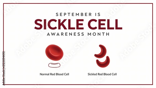 Sickle Cell Awareness Month Graphic with Normal and Sickled Red Blood Cells