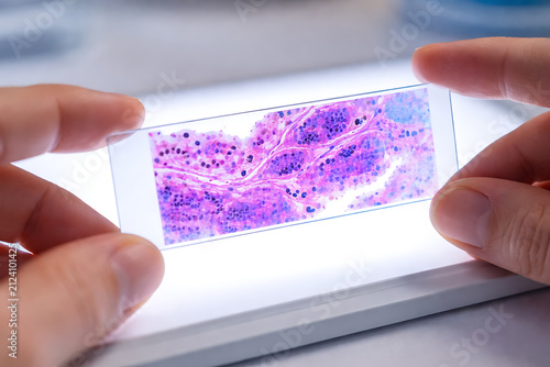 Hands holding microscope slide with stained tissue sample in modern laboratory for pathology diagnosis