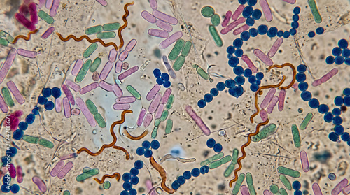 Microorganisms spreading in a hospital setting, concept of hygiene and disease prevention showing bacteria, pathogens, and contamination on metal bed rails touched by a gloved hand.