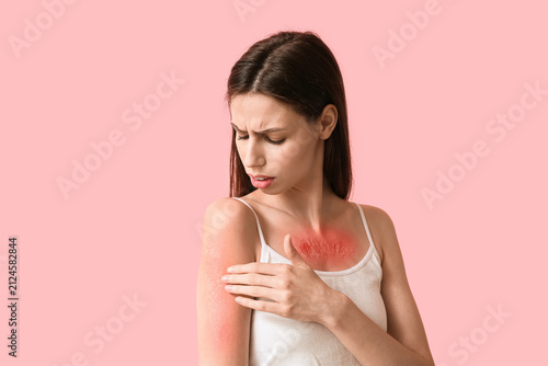 Allergic young woman with r...