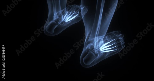 Lumbrical muscles of the foot in the human body. X Ray. Loop