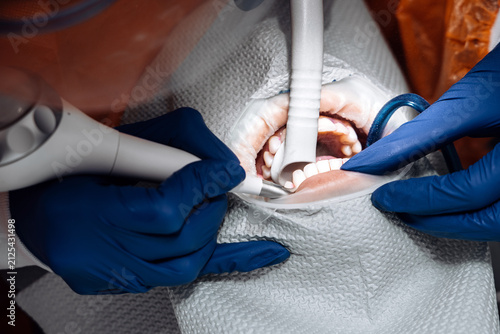 Foto A dentist performs professional teeth cleaning with an ultrasonic scaler