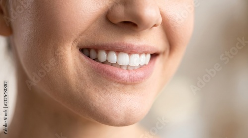 A close-up of a smiling woman's mouth, revealing perfectly white teeth and healthy gums