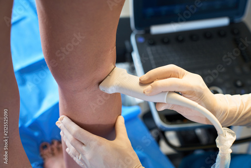 Medical procedure involving an ultrasound scan of a female leg to diagnose and assess the severity of venous insufficiency