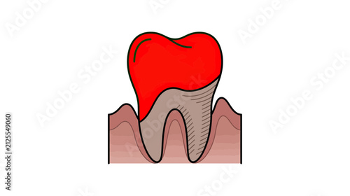 Bild auf Leinwand Isolated inflamed tooth with red gums, dental health concept