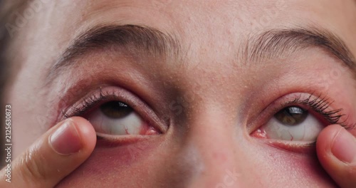 Close-up of a young woman touching her eye, highlighting natural beauty and skincare
