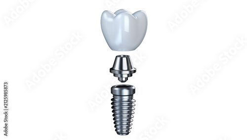 Canvastavla Dental implant components crown abutment and screw, isolated on transparent back