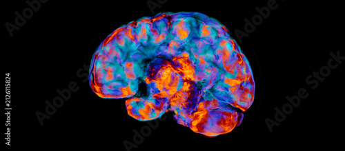 A high-resolution PET-CT scan for the human brain.