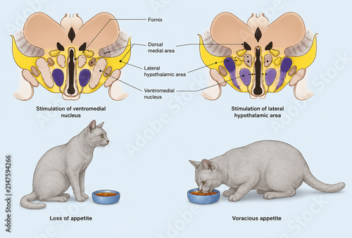 AI generated educational medical infographic comparing hypothalamic appetite regulation showing ventromedial lateral nuclei brain anatomy feeding behavior clinical learning