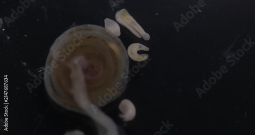 Cestode Larva (Cysticercus) and Strongyloides ratti Parasites in lab.