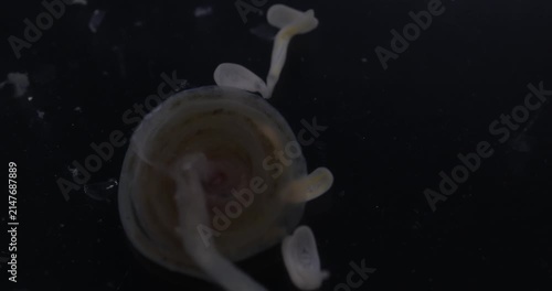 Cestode Larva (Cysticercus) and Strongyloides ratti Parasites in lab.