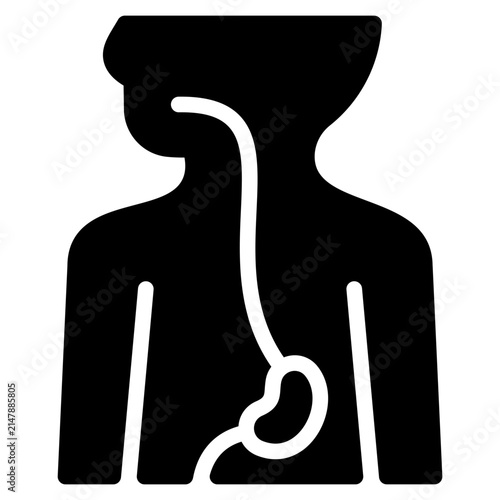 Esophagus
