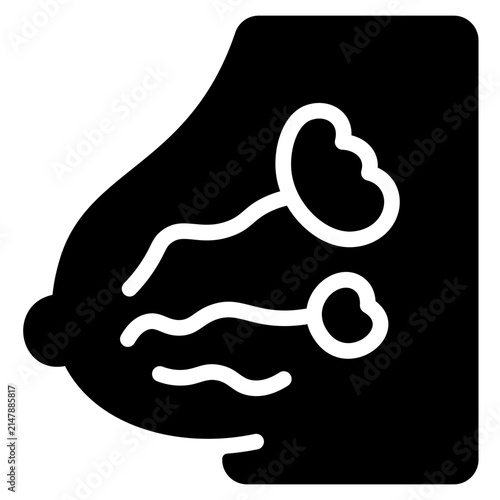 Breast
