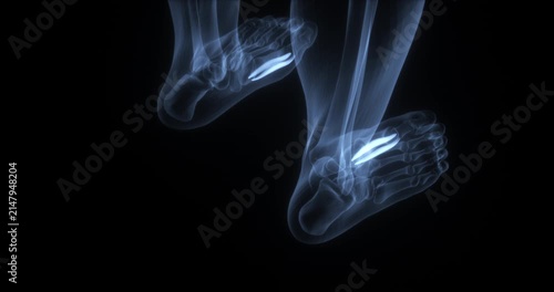 Hallucis brevis muscles in human body. X Ray. Loop