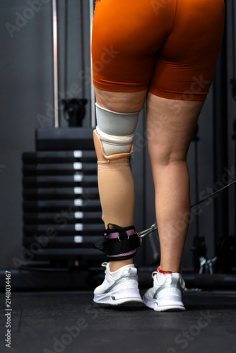 Person with prosthetic leg training in gym, showing self-improvement and dedication
