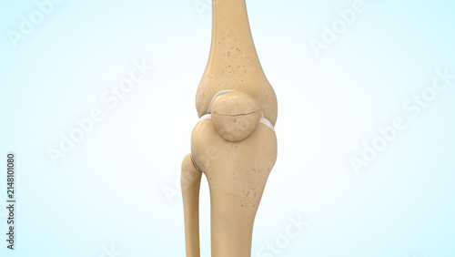 Undisplaced patella fracture of 3d illustration