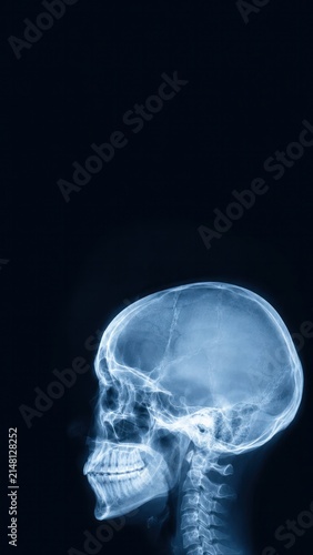 Side view X-ray of human skull and cervical spine, diagnostic imaging concept for medical education