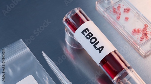 Ebola Virus Blood Sample in Test Tube in Medical Laboratory