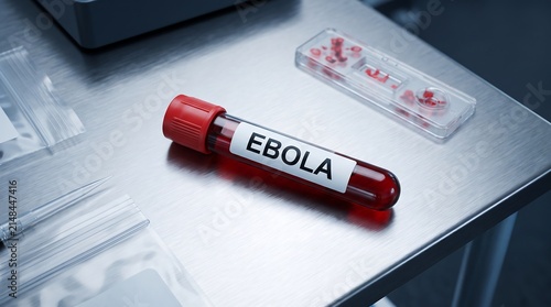 Ebola Virus Blood Sample in Test Tube on Laboratory Bench