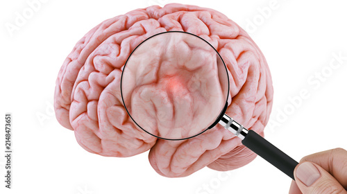 Human brain with red spot magnified by a hand holding a magnifying glass, isolated on transparent background
