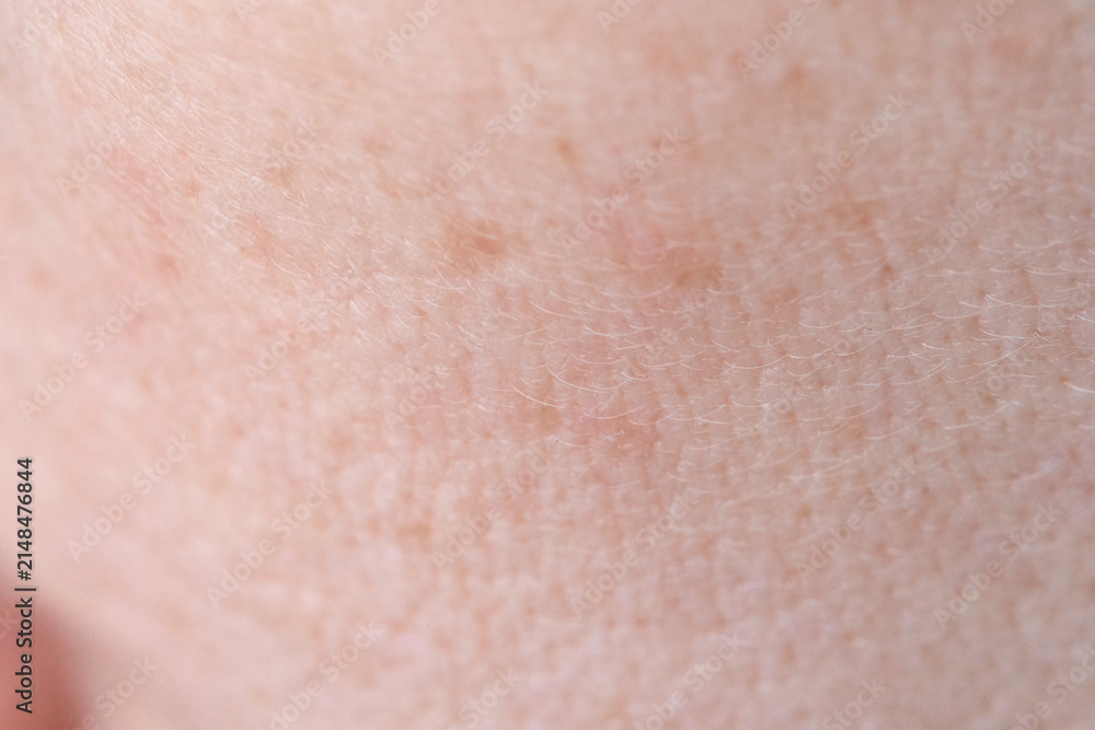 Fototapeta premium Facial Skin Showing Fine Pores Dry Texture And Slight Redness On Cheek Closeup In Neutral Indoor Lighting Macro Clinical Skin Surface Study For Dermatology Reference.
