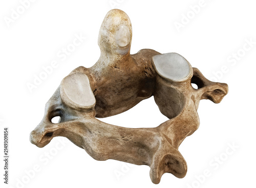 Human cervical vertebra, upper cervical spine, axis C2 anatomy. Anatomical bone model showing vertebral body, superior articular facets and vertebral foramen for medical, orthopedic, educational use