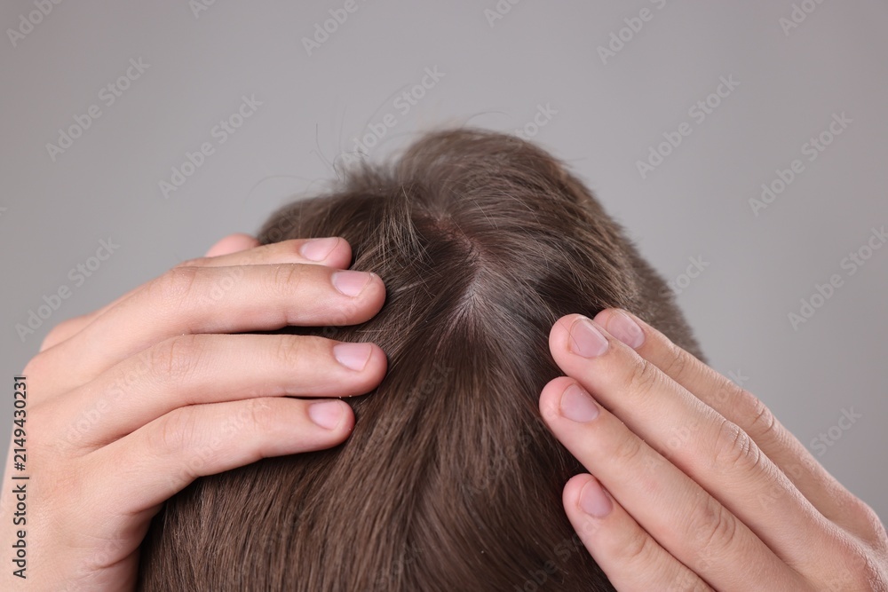 Fototapeta premium Man examining his head on grey background, closeup