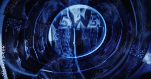 Tracking shot of spine mri scans rotating inside scanner tunnel in dark clinical laboratory rotational tracking.