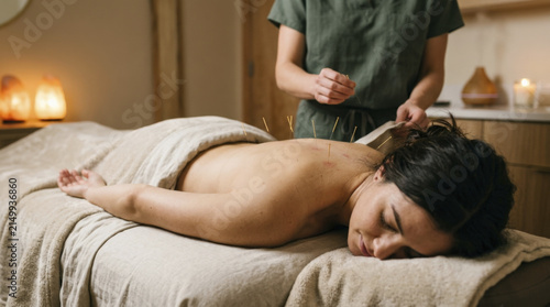 Patient receiving acupuncture treatment on her back in a relaxing spa