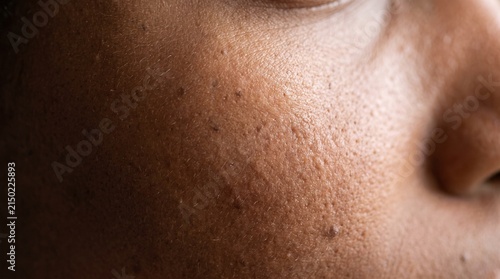 Fotografie Skin Texture Close up Showing Pores and Blemishes on Dark Skin