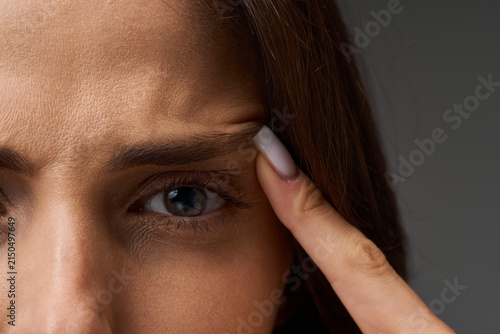 Blepharoplasty and eye lifting assessment. Closeup portrait of a woman pointing her finger at lateral eye corner, demonstrating the potential need for eyelid surgery and brow contour correction