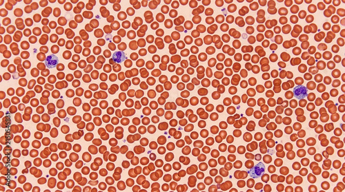 Microscopic view of human blood cells, red corpuscles and leukocytes