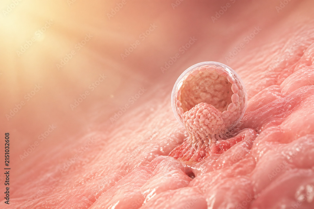 Fototapeta premium Hopeful Blastocyst Beginning Implantation In Soft Light