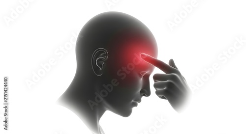 Headache and stress concept: Hand pointing to painful forehead on human head silhouette with red glow.